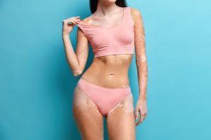 What Makes A Tummy Tuck Medically Necessary
