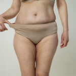 tummy tuck for 50 year old