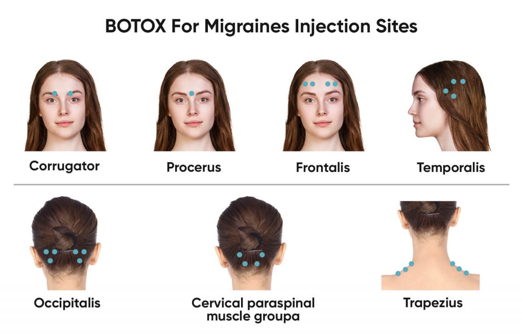 Medical professional consultation for Botox migraine treatment near Jacksonville FL