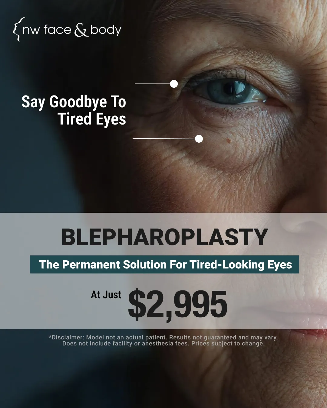 blepharoplasty banner