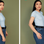Breast Fat Transfer Facts to Know Before Your Surgery
