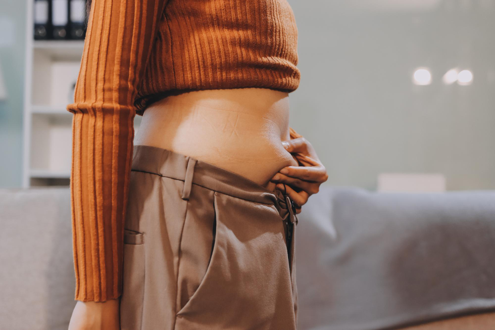 Can Tummy Tuck Surgery in Kirkland Give You a Flat Stomach?
