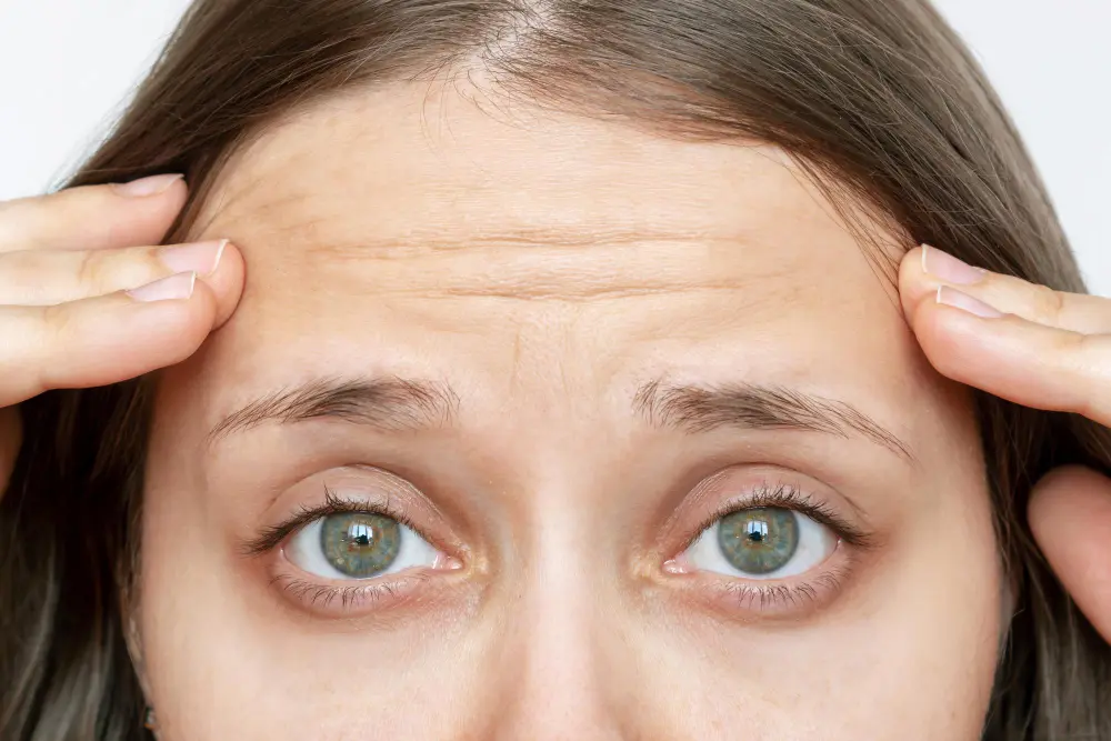 How Long Does Botox Last? Tips to Make Your Results Last Longer