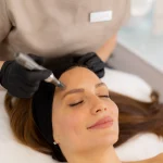 Is Microneedling Worth It Everything You Need to Know