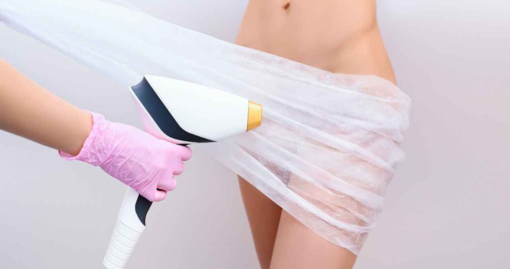 laser pubic hair removal