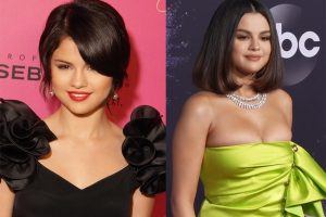 Selena Gomez plastic surgery