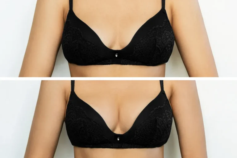 What Should Patients Expect During a Breast Augmentation Consultation