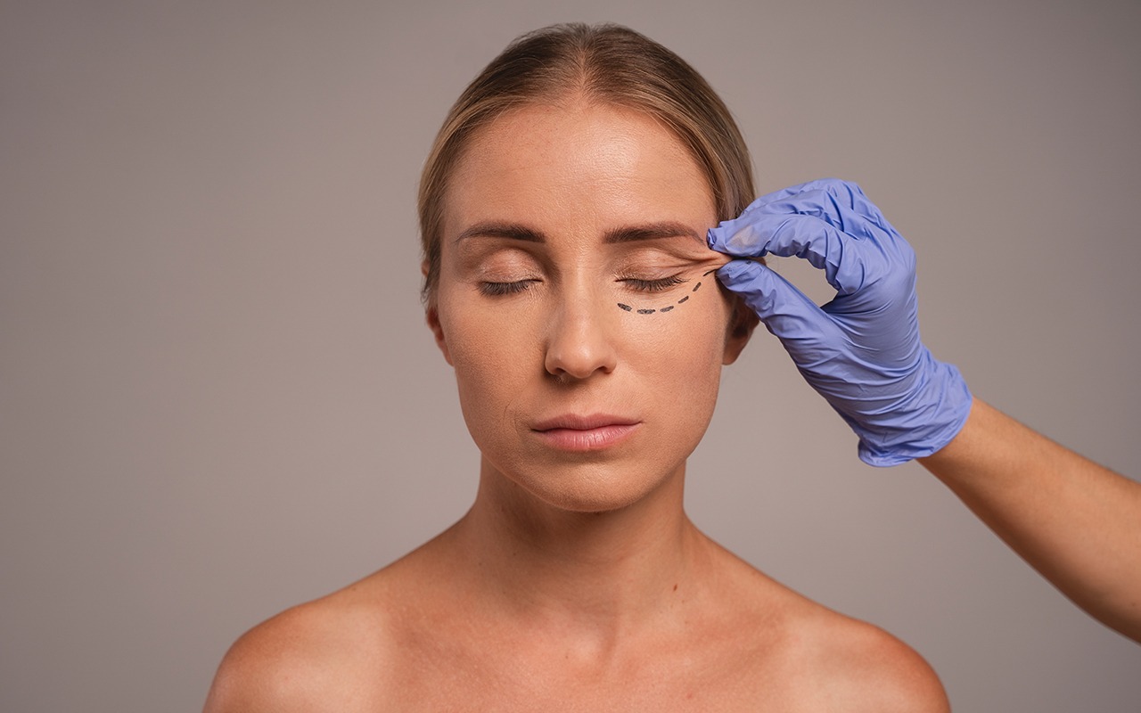 Who Is the Best Eyelid Surgeon in Kirkland?