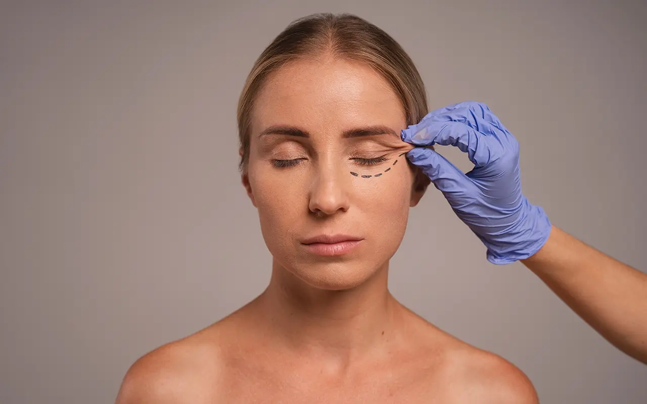 Who Is the Best Eyelid Surgeon in Kirkland?
