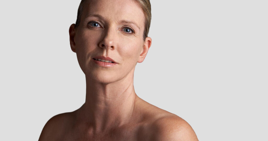 Do You Have to Continue Botox Once You Start