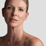 Do You Have to Continue Botox Once You Start