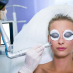What to Avoid After CO₂ Laser Treatment