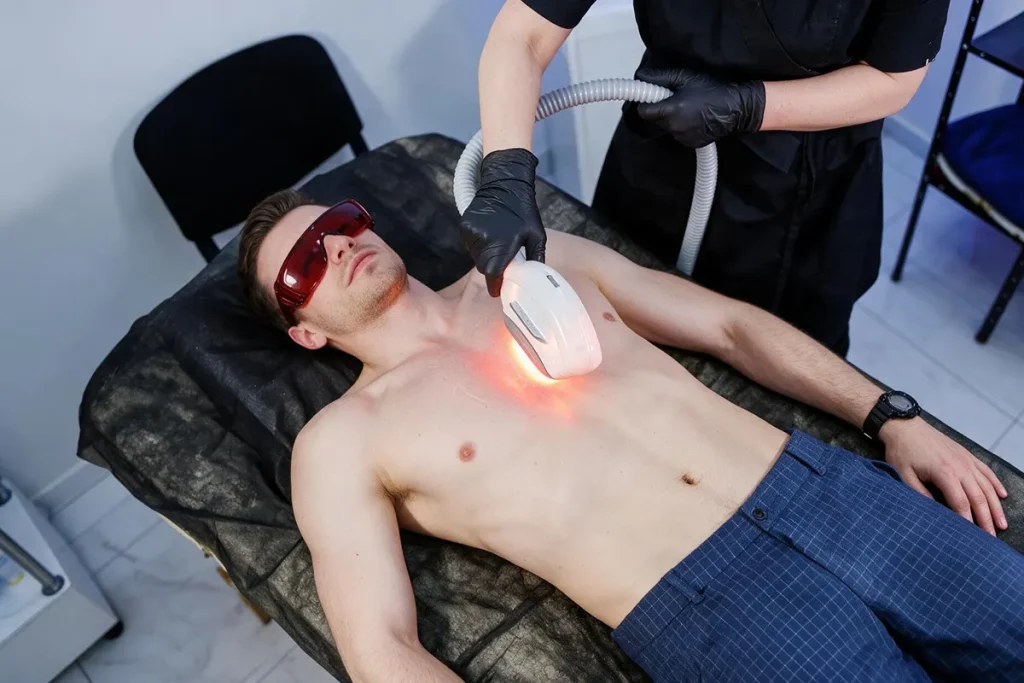 Chest and Abdomen Laser Hair Removal for Men