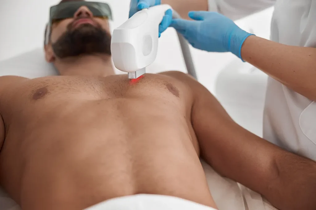 Why Laser Works Differently on Men's Hair?