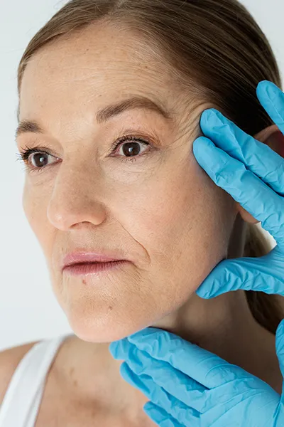 Why Choose AlloClae for Facial Volume?
