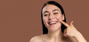 Laser Scar Resurfacing In Bellevue & Kirkland