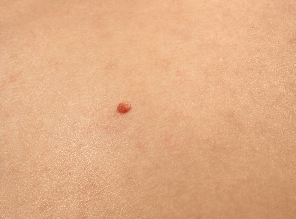 red mole