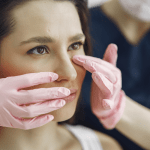 Rhinoplasty
