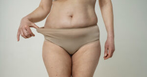 tummy tuck result